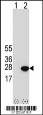Western blot analysis of his-tag GPX7 (arrow) using his tag antibody. 293T cell lysates (2 ug/lane) either nontransfected (Lane 1) or transiently transfected with the GPX7 gene