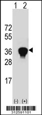 Western blot analysis of his-tag GPS2 (arrow) using his tag antibody. 293T cell lysates (2 ug/lane) either nontransfected (Lane 1) or transiently transfected with the GPS2 gene