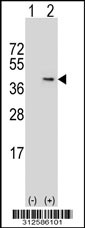 Western blot analysis of his-tag GPD2 (arrow) using his tag antibody. 293T cell lysates (2 ug/lane) either nontransfected (Lane 1) or transiently transfected with the LGALS13 gene
