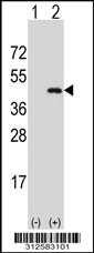 Western blot analysis of his-tag GNAI2 (arrow) using his tag antibody. 293T cell lysates (2 ug/lane) either nontransfected (Lane 1) or transiently transfected with the GNAI2 gene