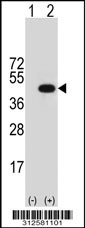 Western blot analysis of his-tag GNA15 (arrow) using his tag antibody. 293T cell lysates (2 ug/lane) either nontransfected (Lane 1) or transiently transfected with the GNA15 gene