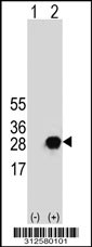 Western blot analysis of his-tag GM2A (arrow) using his tag antibody. 293T cell lysates (2 ug/lane) either nontransfected (Lane 1) or transiently transfected with the GM2A gene