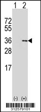 Western blot analysis of his-tag GLUD2 (arrow) using his tag antibody. 293T cell lysates (2 ug/lane) either nontransfected (Lane 1) or transiently transfected with the GLUD2 gene
