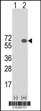 Western blot analysis of his-tag CDCA7L (arrow) using his tag antibody. 293T cell lysates (2 ug/lane) either nontransfected (Lane 1) or transiently transfected with the CDCA7L gene‘