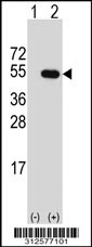 Western blot analysis of his-tag GIF (arrow) using his tag antibody. 293T cell lysates (2 ug/lane) either nontransfected (Lane 1) or transiently transfected with the GIF gene