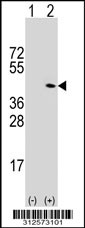 Western blot analysis of his-tag GABRG1 (arrow) using his tag antibody. 293T cell lysates (2 ug/lane) either nontransfected (Lane 1) or transiently transfected with the GABRG1 gene