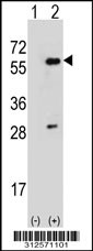 Western blot analysis of his-tag G6PD (arrow) using his tag antibody. 293T cell lysates (2 ug/lane) either nontransfected (Lane 1) or transiently transfected with the G6PD gene