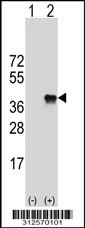 Western blot analysis of his-tag FRZB (arrow) using his tag antibody. 293T cell lysates (2 ug/lane) either nontransfected (Lane 1) or transiently transfected with the FRZB gene