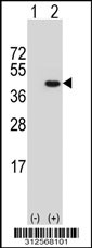 Western blot analysis of his-tag FLOT2 (arrow) using his tag antibody. 293T cell lysates (2 ug/lane) either nontransfected (Lane 1) or transiently transfected with the LGALS12 gene