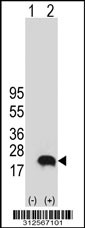 Western blot analysis of his-tag FHIT (arrow) using his tag antibody. 293T cell lysates (2 ug/lane) either nontransfected (Lane 1) or transiently transfected with the FHIT gene