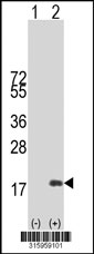 Western blot analysis of his-tag HCFC1R1 (arrow) using his tag antibody. 293T cell lysates (2 ug/lane) either nontransfected (Lane 1) or transiently transfected with the HCFC1R1 gene‘