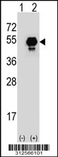 Western blot analysis of his-tag FH (arrow) using his tag antibody. 293T cell lysates (2 ug/lane) either nontransfected (Lane 1) or transiently transfected with the FH gene