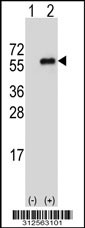Western blot analysis of his-tag FCGR1A (arrow) using his tag antibody. 293T cell lysates (2 ug/lane) either nontransfected (Lane 1) or transiently transfected with the FCGR1A gene
