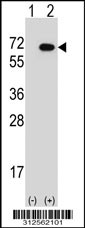 Western blot analysis of his-tag FANCG (arrow) using his tag antibody. 293T cell lysates (2 ug/lane) either nontransfected (Lane 1) or transiently transfected with the FANCG gene