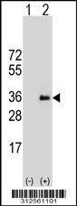Western blot analysis of his-tag FANCA (arrow) using his tag antibody. 293T cell lysates (2 ug/lane) either nontransfected (Lane 1) or transiently transfected with the FANCA gene