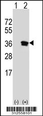 Western blot analysis of his-tag ETFA (arrow) using his tag antibody. 293T cell lysates (2 ug/lane) either nontransfected (Lane 1) or transiently transfected with the ETFA gene