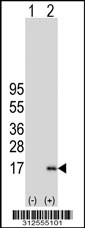 Western blot analysis of his-tag CXCL1 (arrow) using his tag antibody. 293T cell lysates (2 ug/lane) either nontransfected (Lane 1) or transiently transfected with the CXCL1 gene