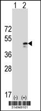 Western blot analysis of his-tag HOXC10 (arrow) using his tag antibody. 293T cell lysates (2 ug/lane) either nontransfected (Lane 1) or transiently transfected with the HOXC10 gene‘
