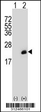 Western blot analysis of his-tag EDN2 (arrow) using his tag antibody. 293T cell lysates (2 ug/lane) either nontransfected (Lane 1) or transiently transfected with the EDN2 gene