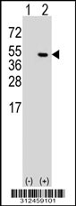 Western blot analysis of his-tag DKC1 (arrow) using his tag antibody. 293T cell lysates (2 ug/lane) either nontransfected (Lane 1) or transiently transfected with the DKC1 gene