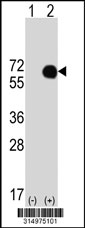 Western blot analysis of his-tag HOXA3 (arrow) using his tag antibody. 293T cell lysates (2 ug/lane) either nontransfected (Lane 1) or transiently transfected with the HOXA3 gene‘