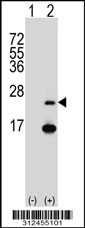 Western blot analysis of his-tag CYB561 (arrow) using his tag antibody. 293T cell lysates (2 ug/lane) either nontransfected (Lane 1) or transiently transfected with the CYB561 gene