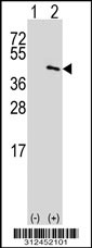 Western blot analysis of his-tag CTH (arrow) using his tag antibody. 293T cell lysates (2 ug/lane) either nontransfected (Lane 1) or transiently transfected with the CTH gene