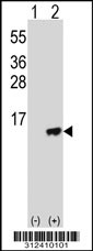 Western blot analysis of his-tag COX7C (arrow) using his tag antibody. 293T cell lysates (2 ug/lane) either nontransfected (Lane 1) or transiently transfected with the COX7C gene