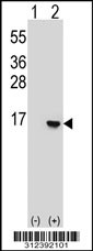 Western blot analysis of his-tag CKS2 (arrow) using his tag antibody. 293T cell lysates (2 ug/lane) either nontransfected (Lane 1) or transiently transfected with the CKS2 gene