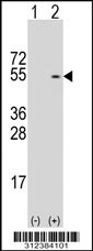 Western blot analysis of his-tag CHRM2 (arrow) using his tag antibody. 293T cell lysates (2 ug/lane) either nontransfected (Lane 1) or transiently transfected with the CHRM2 gene
