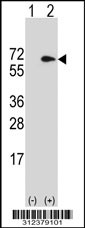 Western blot analysis of his-tag CHD2 (arrow) using his tag antibody. 293T cell lysates (2 ug/lane) either nontransfected (Lane 1) or transiently transfected with the LGALS11 gene