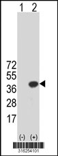 Western blot analysis of his-tag TLX3 (arrow) using his tag antibody. 293T cell lysates (2 ug/lane) either nontransfected (Lane 1) or transiently transfected with the TLX3 gene‘