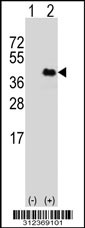 Western blot analysis of his-tag CEACAM7 (arrow) using his tag antibody. 293T cell lysates (2 ug/lane) either nontransfected (Lane 1) or transiently transfected with the CEACAM7 gene