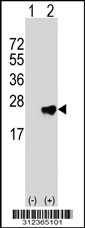 Western blot analysis of his-tag CDKN3 (arrow) using his tag antibody. 293T cell lysates (2 ug/lane) either nontransfected (Lane 1) or transiently transfected with the CDKN3 gene