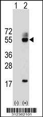 Western blot analysis of his-tag CD86 (arrow) using his tag antibody. 293T cell lysates (2 ug/lane) either nontransfected (Lane 1) or transiently transfected with the CD86 gene