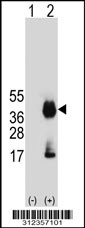Western blot analysis of his-tag CD7 (arrow) using his tag antibody. 293T cell lysates (2 ug/lane) either nontransfected (Lane 1) or transiently transfected with the CD7 gene