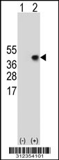 Western blot analysis of his-tag CD58 (arrow) using his tag antibody. 293T cell lysates (2 ug/lane) either nontransfected (Lane 1) or transiently transfected with the CD58 gene