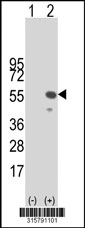 Western blot analysis of his-tag ZNF239 (arrow) using his tag antibody. 293T cell lysates (2 ug/lane) either nontransfected (Lane 1) or transiently transfected with the ZNF239 gene‘