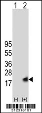 Western blot analysis of his-tag AIF1 (arrow) using his tag antibody. 293T cell lysates (2 ug/lane) either nontransfected (Lane 1) or transiently transfected with the AIF1 gene
