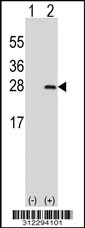 Western blot analysis of his-tag AZU1 (arrow) using his tag antibody. 293T cell lysates (2 ug/lane) either nontransfected (Lane 1) or transiently transfected with the AZU1 gene