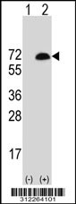 Western blot analysis of his-tag BIRC3 (arrow) using his tag antibody. 293T cell lysates (2 ug/lane) either nontransfected (Lane 1) or transiently transfected with the BIRC3 gene