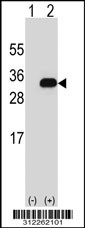 Western blot analysis of his-tag BCOR (arrow) using his tag antibody. 293T cell lysates (2 ug/lane) either nontransfected (Lane 1) or transiently transfected with the LGALS8 gene