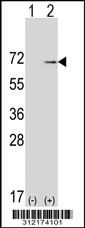 Western blot analysis of his-tag HSF2 (arrow) using his tag antibody. 293T cell lysates (2 ug/lane) either nontransfected (Lane 1) or transiently transfected with the HSF2 gene