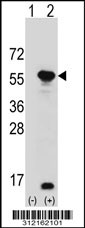 Western blot analysis of his-tag USP3 (arrow) using his tag antibody. 293T cell lysates (2 ug/lane) either nontransfected (Lane 1) or transiently transfected with the USP3 gene