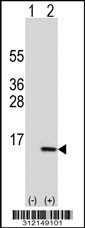 Western blot analysis of his-tag MAP1LC3B (arrow) using his tag antibody. 293T cell lysates (2 ug/lane) either nontransfected (Lane 1) or transiently transfected with the LGALS6 gene