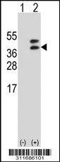 Western blot analysis of his-tag EMD (arrow) using his tag antibody. 293T cell lysates (2 ug/lane) either nontransfected (Lane 1) or transiently transfected with the LGALS5 gene