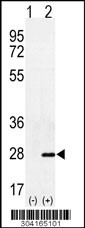 Western blot analysis of his-tag COASY (arrow) using his tag antibody. 293 cell lysates (2 ug/lane) either nontransfected (Lane 1) or transiently transfected with the COASY gene