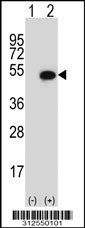 Western blot analysis of his-tag CYLC2 (arrow) using his tag antibody. 293 cell lysates (2 ug/lane) either nontransfected (Lane 1) or transiently transfected with the CYLC2 gene