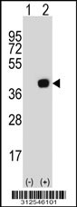 Western blot analysis of his-tag DTNA (arrow) using his tag antibody. 293 cell lysates (2 ug/lane) either nontransfected (Lane 1) or transiently transfected with the DTNA gene
