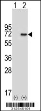 Western blot analysis of his-tag DPYS (arrow) using his tag antibody. 293 cell lysates (2 ug/lane) either nontransfected (Lane 1) or transiently transfected with the DPYS gene